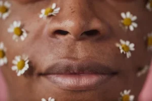 Visage d'une peau noire en hyperséborhée et acnéique
